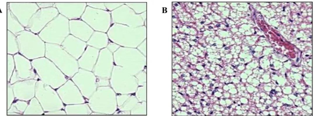 Figure 1: Comparative image of two different kinds of adipose tissue. White adipose has  little cytoplasm and has huge oil droplet (A)