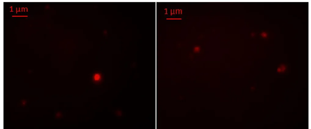 Figure  13.  Fluorescence microscopy images  of lipid  vesicles  labelled  with  Rhodamine B dye and visualized with a 100 X objective 