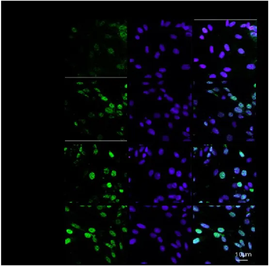 Figure 4.2 A: Effect of IS (30 μM) on p65 nuclear translocation in C6 cells.  Nuclear translocation of NF-kB p65 subunit was detected using 