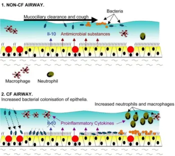 Figure 11: Infection and inflammation status in CF airways 