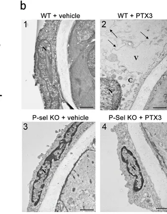 Figura 5.  a)  curva dose-risposta  all'acetilcolina (Ach) di arterie mesenteriche di topi 