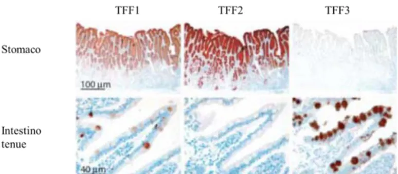Figura 1.9 Immagini di immunoistochimica che mostrano la localizzazione tissutale di TFF1, TFF2 e 