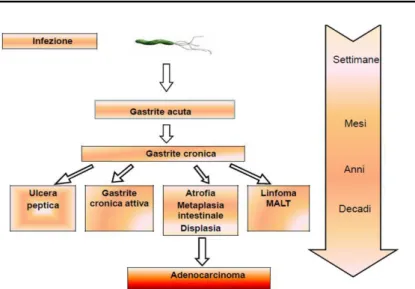 Figura 1.18  Spettro delle manifestazioni cliniche associate all’infezione da H. pylori 