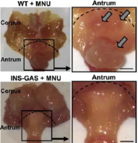 Figura 1.11: Nei topi wt il trattamento con N-methyl-N-nitrosourea (MNU) induce la formazione 