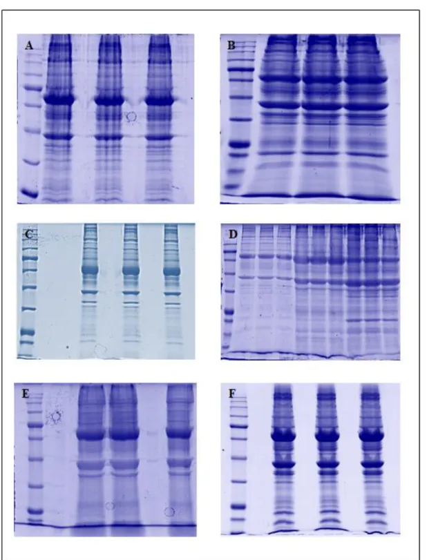 Figure  3.2.  One-dimensional  SDS-PAGE  of  protein  extracts  of  umbilical  cords  from  healthy 