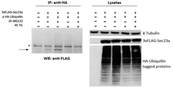 Fig. 18 TG reduces the  ubiquitination  of Sec23a.  HuH7 cells were co-transfected with 4  g of the pHA-Ubiquitin expression vector plus 4 g of the 3xFLAG-Sec23 vector, as indicated