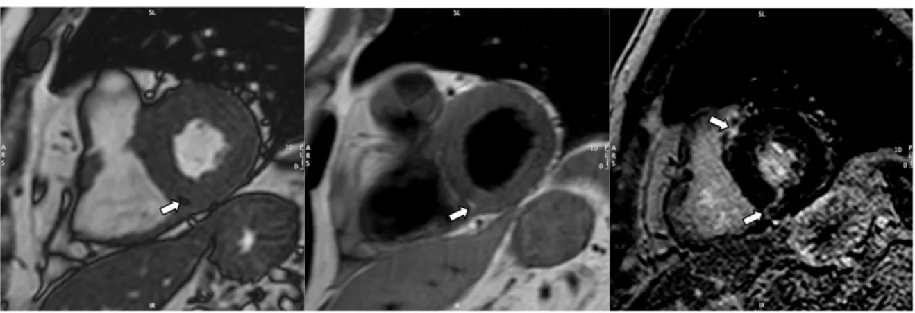 Fig. 2 A. Cardiac MRI. 