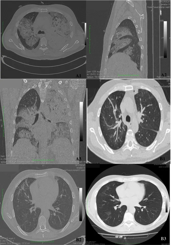 Figure 2. Chest CT images. 