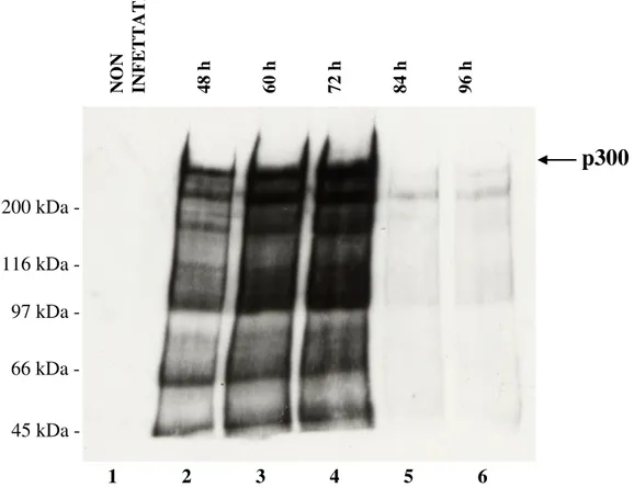 Figura 3.6 Espressione di p300 ricombinante in cellule Sf9 raccolte a tempi diversi dall’infezione: le cellule di insetto sono state infettate con diluizione virale 1:1, raccolte 48 h (corsia 2), 60 h (corsia 3), 72 h (corsia 4), 84 h (corsia 5) e 96 h (co