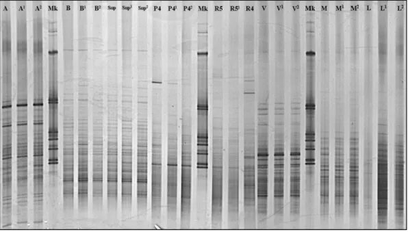 Fig  12.  Foto  del  gel  di poliacrilammide  dopo  corsa  elettroforetica  dei prodotti  amplificati