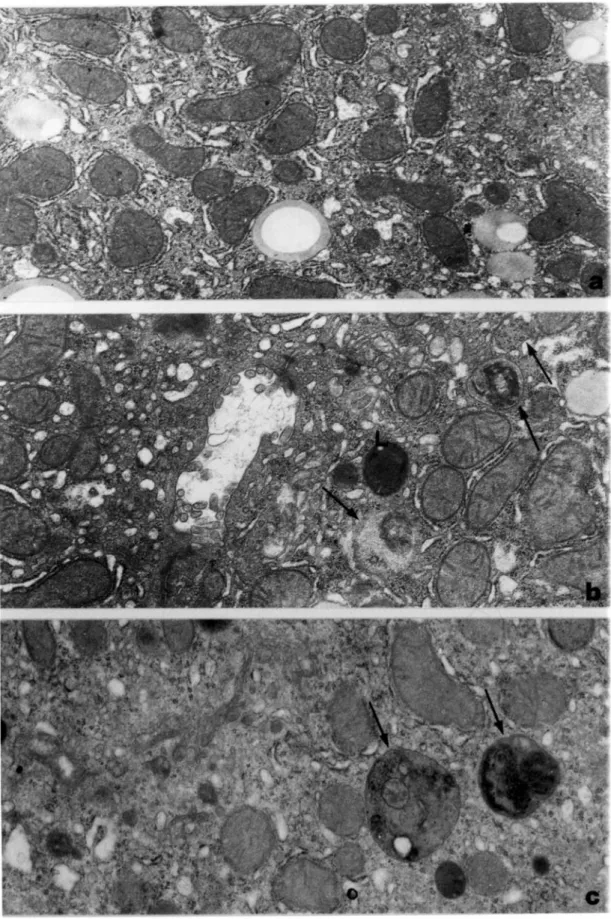 Figura 5   Immagini al microscopio elettronico (18400x)di cellule di fegato di ratto. I campioni 