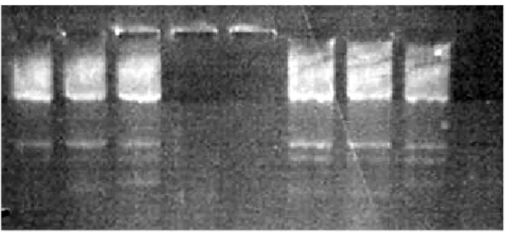 Figura  9:  Prodotti  di  PCR  corsi  su  gel  di  agorosio  e  analizzati  al  transilluminatore:           l’amplificazione di CYP2A6 è eccessivamente forte rispetto a quella dei geni GSTM1 e  TP53
