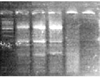Figura 10: Prodotti di PCR corsi su gel di agarosio e analizzati al tranilluminatore: il  controllo positivo CYP2A6 risulta essere ancora troppo accentuato sul gel