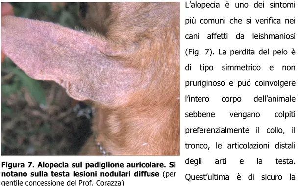 Figura 7. Alopecia sul padiglione auricolare. Si  notano sulla testa lesioni nodulari diffuse  (per  gentile concessione del Prof
