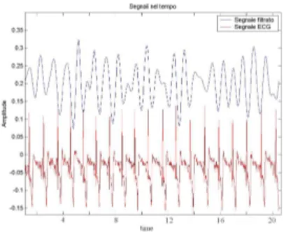 Figura 8: Trasformate di Fourier del segnale filtrato e dell’ECG.