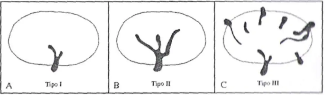 Fig. 3.3:  Quadri vascolari osservati: A) singolo polo vascolare (Tipo I); B) singolo