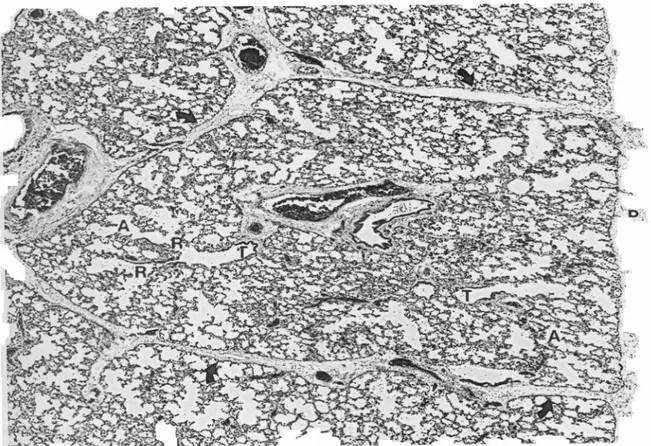 Fig.  11.  Aspetto  istologico  di un  lobulo secondario.  A,  dotto  alveolare;  frecce,  setto interlobulare;  P,  pleura;  R,  bronchiolo  respiratorio;  S,  sacco  alveolare;  T,  bronchiolo terminale