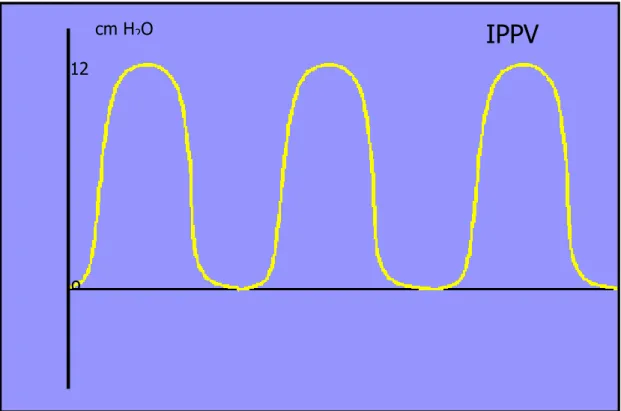 Figura 2.2: Rappresentazione grafica IPPV 