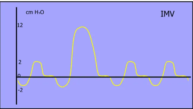 Figura 2.3: Rappresentazione grafica IMV 