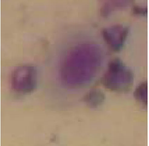 Figura n°2: Cellula epiteliale parabasale; Colorazione Diff Quik.  