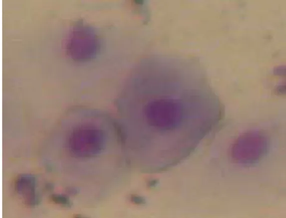 Figura n°3 :  Cellule epiteliali intermedie; Colorazione Diff Quik.