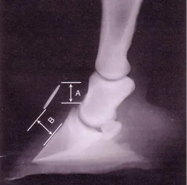 Fig. 5 dislocazione verticale della terza falange rispetto alla scatola cornea. Con A si  indica  l’aumentata  distanza  fra  il  processo  estensorio  e  la  corona,  can  B  è  indicata  l’aumentata  distanza  fra  la  parete  dorsale  della  falange  e 