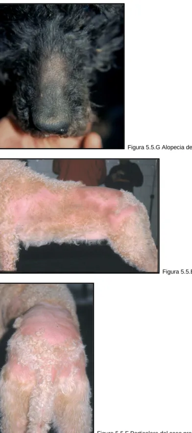 Figura 5.5.G Alopecia del dorso del naso. 