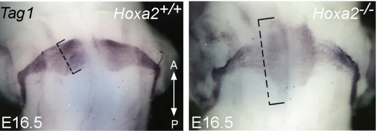 Fig  10.  Alterazione  della  migrazione  dei  precursori  pontini  nel  mutante  Hoxa2.