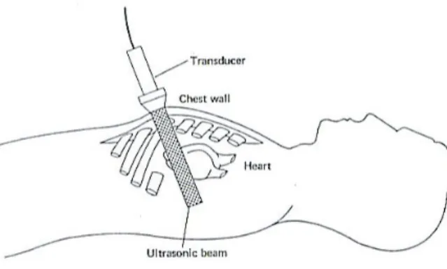 Figura 1.7: Posizionamento del trasduttore