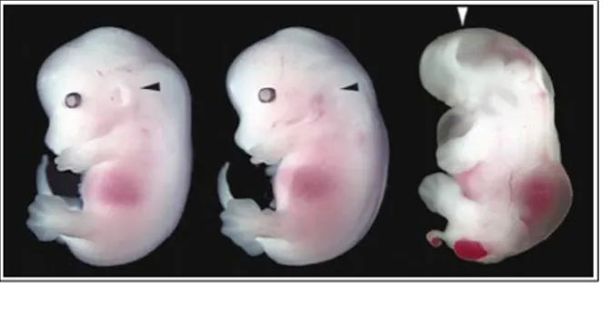 Fig. 1.7 – Effetti fenotipici degli embrioni Chd -/- ;Nog +/+  e Chd -/- ;Nog -/- . A sinistra: Embrione normale a 