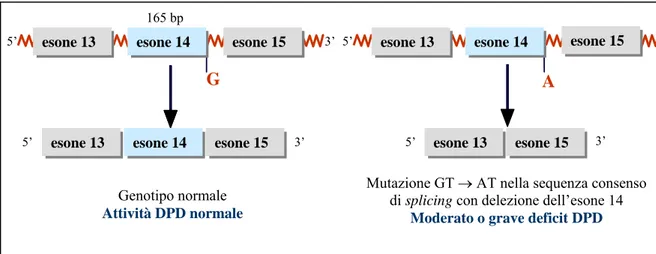 Fig. 4. Mutazione nel sito di splicing dell’esone 14 del gene DPD 