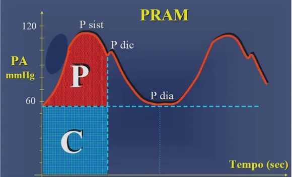Figura C:   Analisi dell’onda arteriosa con Metodo PRAM per il Calcolo di SV 