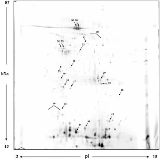 Fig 13: Gel rappresentativo Sindrome di Sjogren 