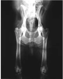 Figura  3.2  (sopra):  Corretto  posizionamento  per  l’esecuzione  di  una  radiografia  in  proiezione  ventro-dorsale  standard  della  pelvi