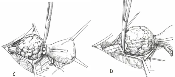 Figura 3.5.1. C: resezione dell’uretra a livello del margine craniale della prostata. D: resezione  dell’uretra a livello del margine caudale della prostata (Slatter, 2005)