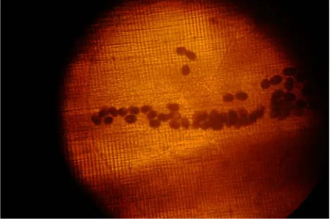 Fig. 3.7 uova di Ascaridia nell’apparato genitale femminile 