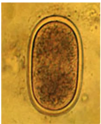 Fig. 3.8 uovo di Heterakis sp. 