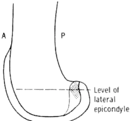Figura 9: superficie mediale del condilo femorale  Figura 10: superficie laterale del condilo 