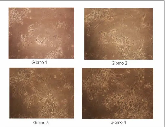 Figura 3.5 Neuroni mesencefalici di topo seminati con densità di 250000 cellule/cm 2