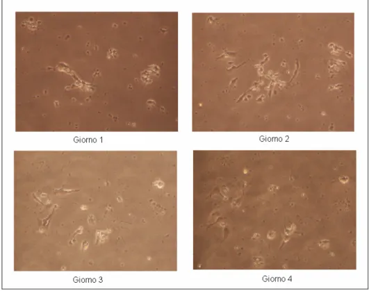 Figura 3.7 Neuroni mesencefalici di topo seminati con densità di 100000 cellule/cm 2