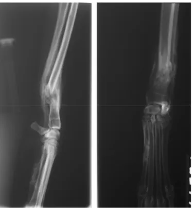 Figura 7. 3: Aspetto radiografico dell'avvenuto consolidamento con errato allineamento