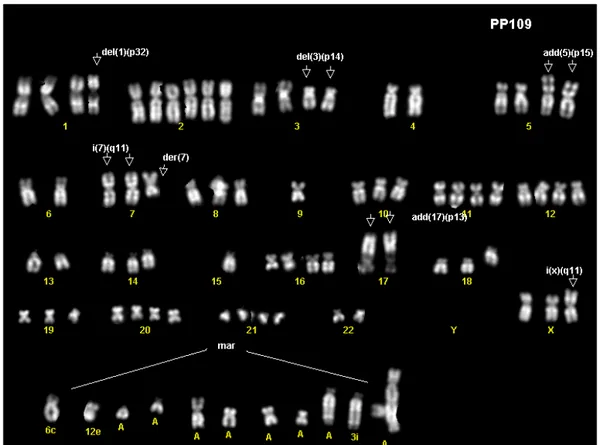 Fig. 25.  Karyotype of 4 cell lines cell lines