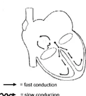 fig. 3: Mechanism of Atrial Flutter(Intra-Atrial Re-entrant Tachycardia) 