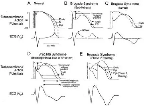 fig. 4: Schematic showing right ventricular epicardial action potential changes 