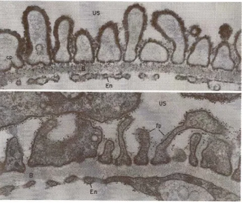 Fig. 2 - Struttura del glomerulo. Immagini al microscopio elettronico della struttura del  glomerulo