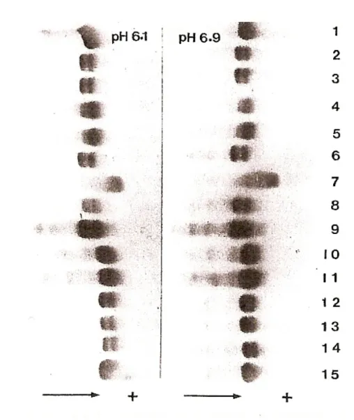 Fig. 13. Mobilità elettroforetiche a confronto tra l’HSA normale e alcune varianti. A sinistra 