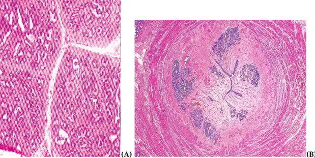 FIG 1.3.2:  Prostata di cane sana; istologia: A)Corpo, B)Parte disseminata    