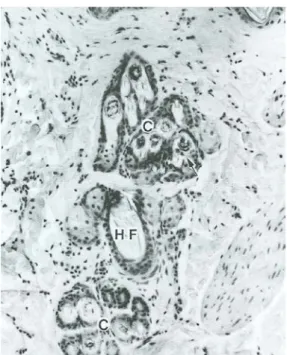 Figura 5: Gruppo di follicoli nella pelle di gatto. Il follicolo pilifero primario(HF) è 