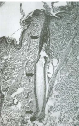 Figura 6: Regioni del follicolo pilifero (dall’alto in basso): infundibulo, istmo e segmento 
