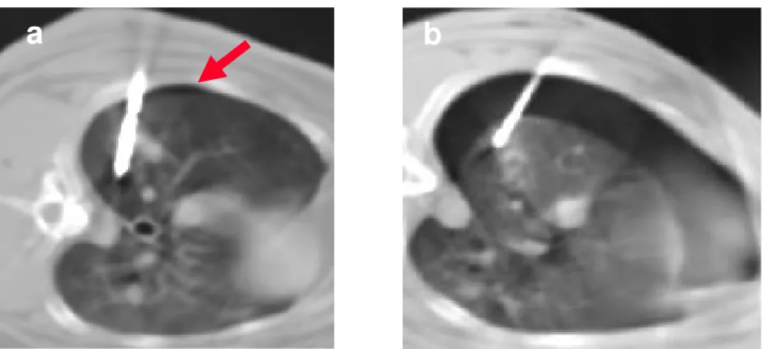 Fig. 3 (a,b). Pneumothorax of mild entity in a rabbit of the group submitted to MW 